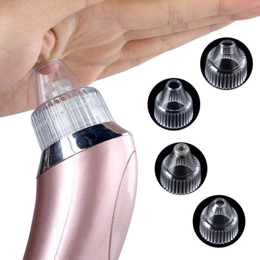 Extractor De Puntos Negros