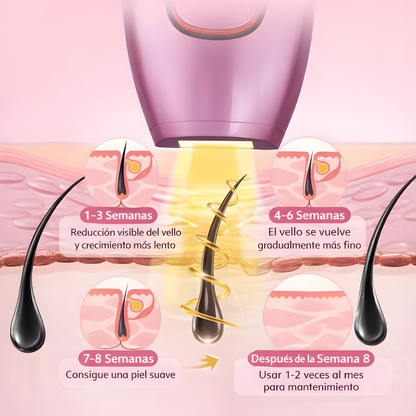 Depiladora Láser IPL